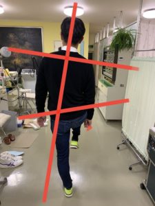 アイ フットケアインソール　左片足立ち　インソール作製前