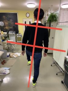 アイ フットケアインソール　右片足立ち　インソール作製前