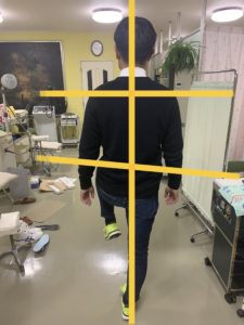 アイ フットケアインソール　右片足立ち　インソール作製後