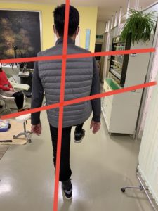 アイ フットケアインソール　左片足立ち　インソール作製前