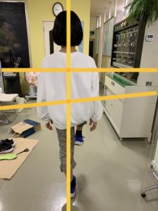 アイ フットケアインソール　左片足立ち　インソール作製後